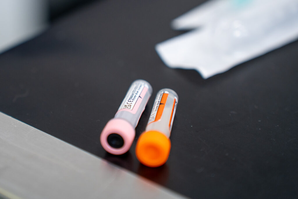 Rosevean Veterinary Practice - Small Animal (Web) 014 Two blood collection tubes with coloured caps, one pink and one orange, are placed on a black surface with medical packaging blurred in the background.